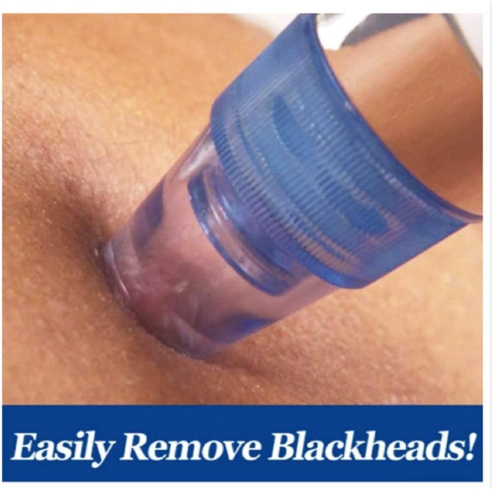 💆♀️ Pore Cleaning Device ✨ | Blackhead Remover Vacuum 🔋 USB Rechargeable 🌟